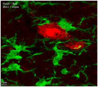 Combining RNAscope and immunohistochemistry to visualize inflammatory gene products in neurons and microglia